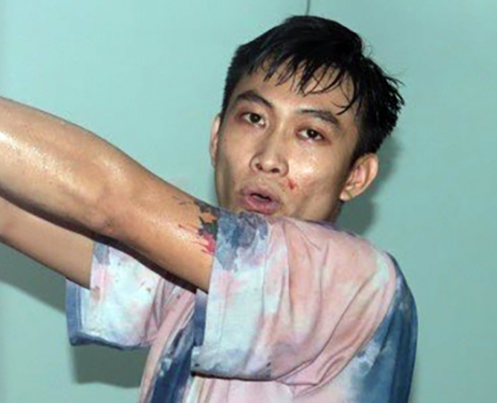 Gã ngáo đá chém 3 người bị thương