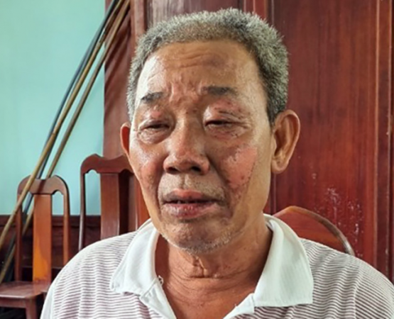 Sát hại chủ nợ, đốt thi thể